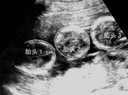 加州CCRH试管医院，获得四重官方认证的辅助生殖机构